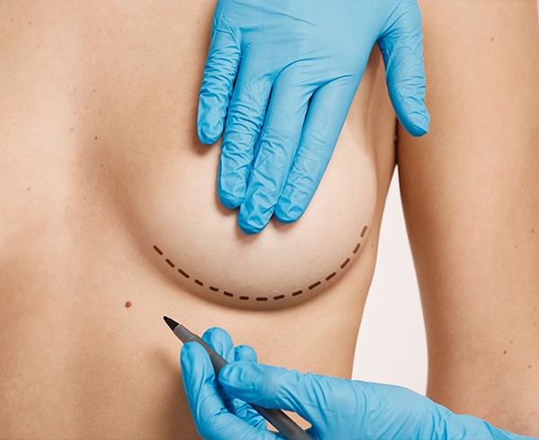 Göğüs Dikleştirme